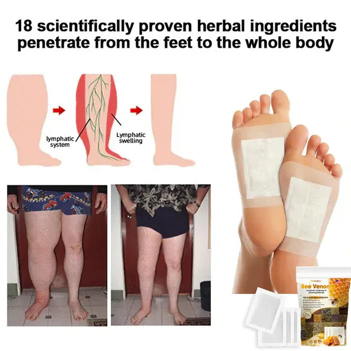 Original Bee Venom Foot Patch II Detox Patches (Set of 10+10) - Buy 10 Get 10 Free @ ₹599 ✅