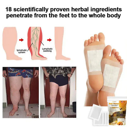 Original Bee Venom Foot Patch II Detox Patches (Set of 10+10) - Buy 10 Get 10 Free @ ₹599 ✅